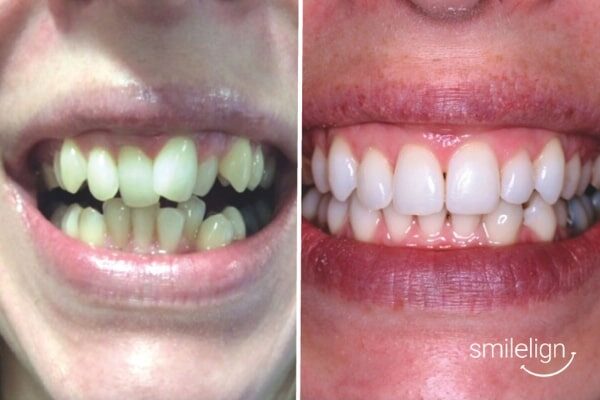 Smiles & Beyond