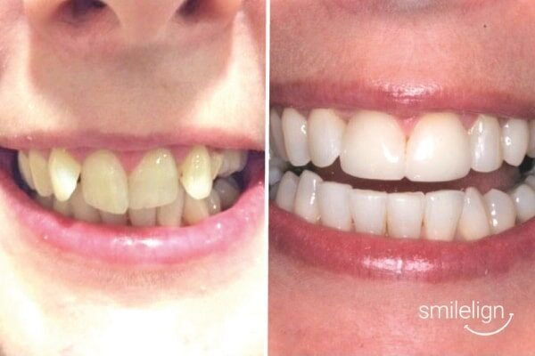 Smiles & Beyond