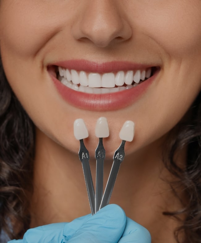 Treatment Category - Smiles & Beyond