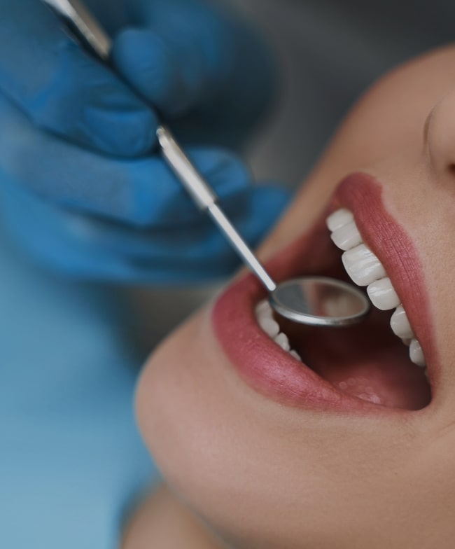Treatment -  Smiles & Beyond