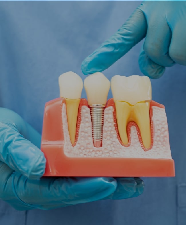 Treatment Category - Smiles & Beyond