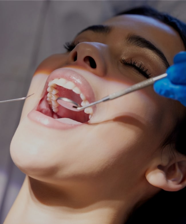 Treatment Category - Smiles & Beyond