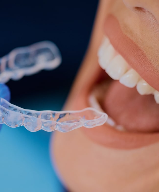 Treatment -  Smiles & Beyond