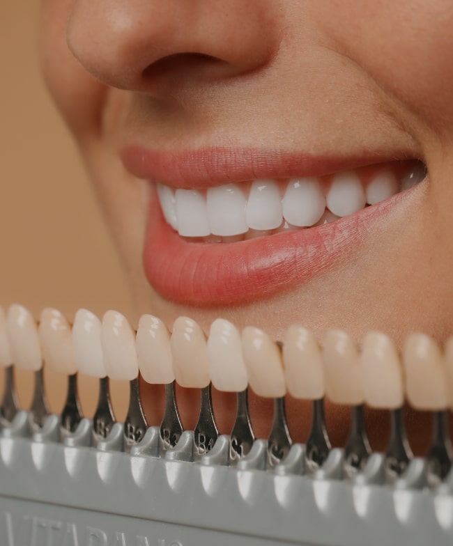 Treatment -  Smiles & Beyond